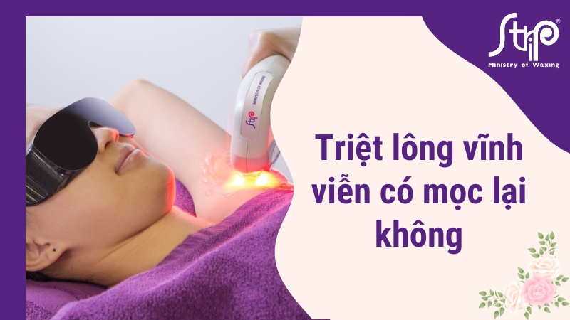 Triệt lông vĩnh viễn có mọc lại không?