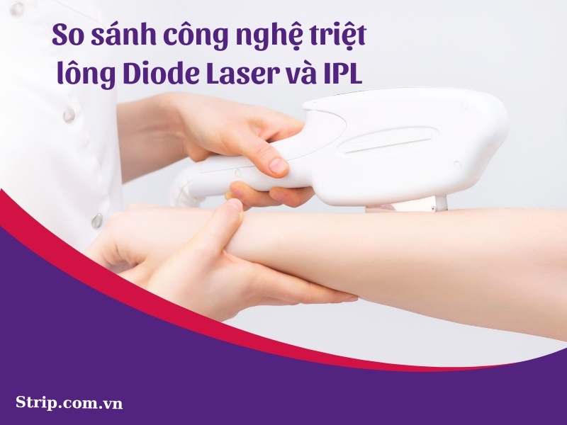 So sánh công nghệ triệt lông Diode Laser và IPL